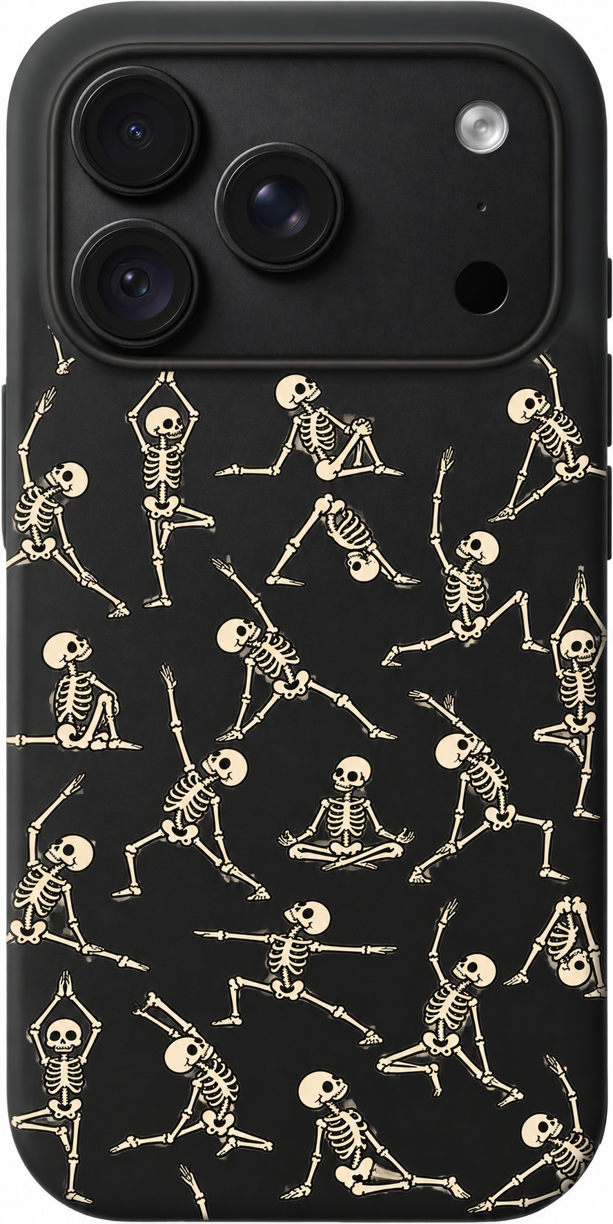 Skeleton Stretch Club iPhone case design preview in Black. Model-specific fit and camera openings vary.